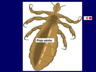 Piojo adulto 