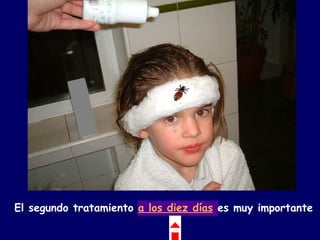 El segundo tratamiento   a los diez días   es muy importante   