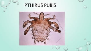 PTHIRUS PUBIS
 