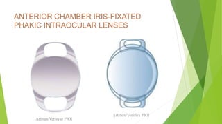 ANTERIOR CHAMBER IRIS-FIXATED
PHAKIC INTRAOCULAR LENSES
Artisan/Verisyse PIOl
Artiflex/Veriflex PIOl
 