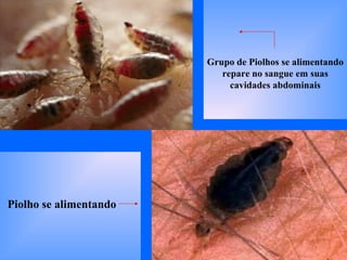 Piolho se alimentando Grupo de Piolhos se alimentando repare no sangue em suas cavidades abdominais 