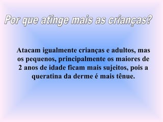 Atacam igualmente crianças e adultos, mas
os pequenos, principalmente os maiores de
2 anos de idade ficam mais sujeitos, pois a
queratina da derme é mais tênue.
 