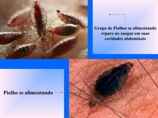 Piolho se alimentando
Grupo de Piolhos se alimentando
repare no sangue em suas
cavidades abdominais
 