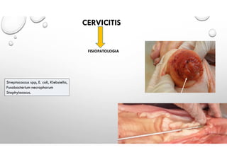 CERVICITIS
FISIOPATOLOGIA
Streptococcus spp, E. coli, Klebsiella,
Fusobacterium necrophorum
Staphylococus.
 