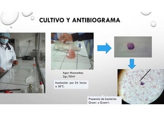 CULTIVO Y ANTIBIOGRAMA
Agar Macconkey
2gr/50ml
Incubación por 24 horas
a 36°C.
Presencia de bacterias
Gram- y Gram+.
 