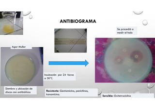 ANTIBIOGRAMA
Se procedió a
medir el halo
Sensible: Oxitetraciclina
Agar Muller
Siembre y ubicación de
discos con antibióticos
Incubación por 24 horas
a 36°C.
Resistente: Gentamicina, penicilinas,
kanamicina.
 