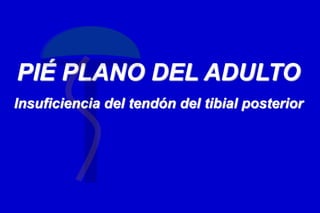 PIÉ PLANO DEL ADULTO
Insuficiencia del tendón del tibial posterior
 