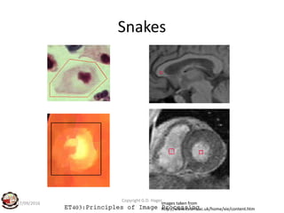 Snakes
ET403:Principles of Image Processing
17/09/2016
Copyright G.D. Hager
Images taken from
http://www.cs.bris.ac.uk/home/xie/content.htm
 