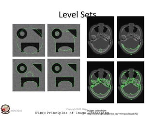 Level Sets
ET403:Principles of Image Processing
17/09/2016
Copyright G.D. Hager
Images taken from
http://www.cgl.uwaterloo.ca/~mmwasile/cs870/
 