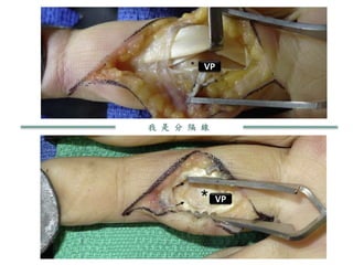 我 是 分 隔 線
VP
VP
 