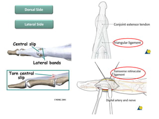 Dorsal Side
Lateral Side
 