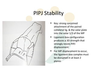 PIPJ Stability
        Key: strong conjoined
         attachment of the paired
         collateral lig. & the volar plate
         into the volar 1/3 of the MP
        Ligament-box configuration
         produces a 3D strength that
         strongly resists PIPJ
         displacement
        For MP displacement to occur,
         the ligament-box complex must
         be disrupted in at least 2
         planes
 