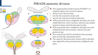 PI RADS v2: An Insight | PPTX