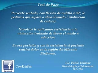 Sindrome del Piramidal o Piriforme