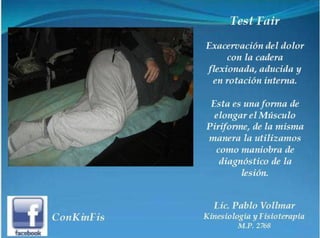 Sindrome del Piramidal o Piriforme