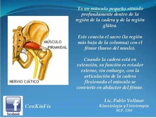 Sindrome del Piramidal o Piriforme