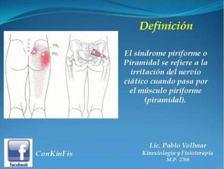 Sindrome del Piramidal o Piriforme