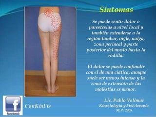 Sindrome del Piramidal o Piriforme