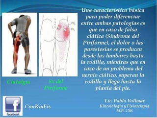 Sindrome del Piramidal o Piriforme