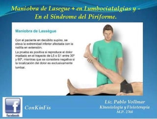 Sindrome del Piramidal o Piriforme