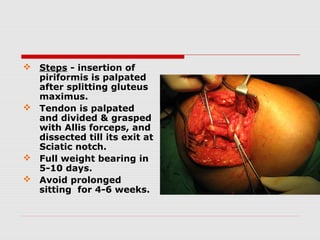 Steps - insertion of
piriformis is palpated
after splitting gluteus
maximus.
 Tendon is palpated
and divided & grasped
with Allis forceps, and
dissected till its exit at
Sciatic notch.
 Full weight bearing in
5-10 days.
 Avoid prolonged
sitting for 4-6 weeks.
 