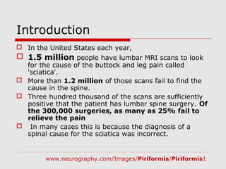Introduction
 In the United States each year,
 1.5 million people have lumbar MRI scans to look
for the cause of the buttock and leg pain called
'sciatica'.
 More than 1.2 million of those scans fail to find the
cause in the spine.
 Three hundred thousand of the scans are sufficiently
positive that the patient has lumbar spine surgery. Of
the 300,000 surgeries, as many as 25% fail to
relieve the pain
 In many cases this is because the diagnosis of a
spinal cause for the sciatica was incorrect.
www.neurography.com/Images/Piriformis/Piriformis1
 