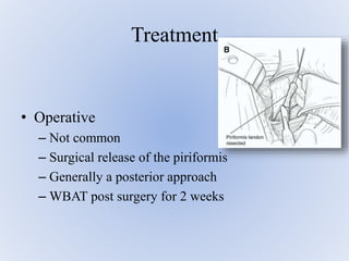 • Operative
– Not common
– Surgical release of the piriformis
– Generally a posterior approach
– WBAT post surgery for 2 weeks
Treatment
 