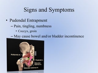 • Pudendal Entrapment
– Pain, tingling, numbness
• Coccyx, groin
– May cause bowel and/or bladder incontinence
Signs and Symptoms
 