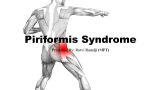 Piriformis Syndrome
Presented By: Rutvi Raualji (MPT)
 