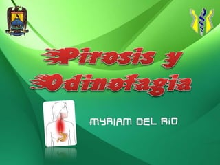Pirosis y Odinofagia Myriam Del Río 