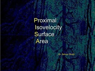 PProximalroximal
IIsovelocitysovelocity
SSurfaceurface
AArearea
Dr. Sehran BhattiDr. Sehran Bhatti
 