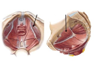 M. Obturador Interno
 