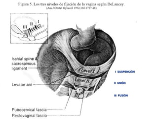I SUSPENCIÓNI SUSPENCIÓN
II UNIÓNII UNIÓN
III FUSIÓNIII FUSIÓN
 