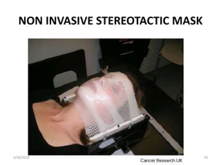NON INVASIVE STEREOTACTIC MASK
3/30/2019 20
 