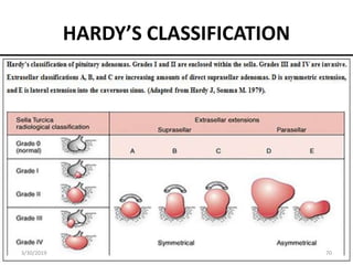 HARDY’S CLASSIFICATION
3/30/2019 70
 