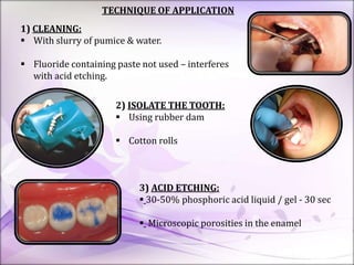 TECHNIQUE OF APPLICATION
1) CLEANING:
 With slurry of pumice & water.
 Fluoride containing paste not used – interferes
with acid etching.
2) ISOLATE THE TOOTH:
 Using rubber dam
 Cotton rolls
3) ACID ETCHING:
 30-50% phosphoric acid liquid / gel - 30 sec
 Microscopic porosities in the enamel
 
