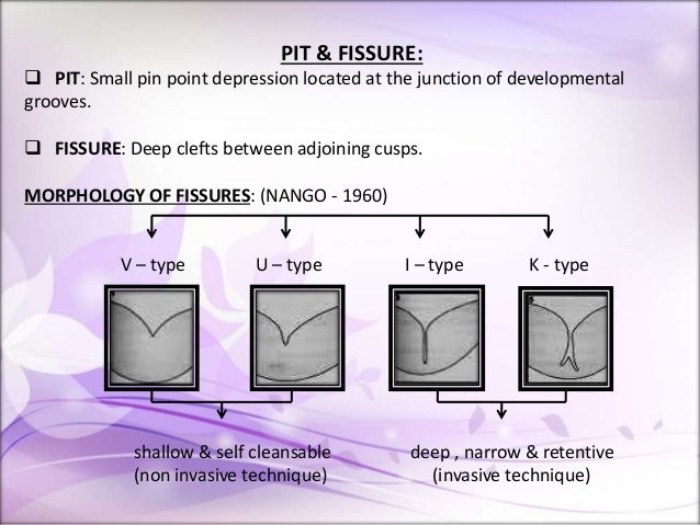 pit-and-fissure