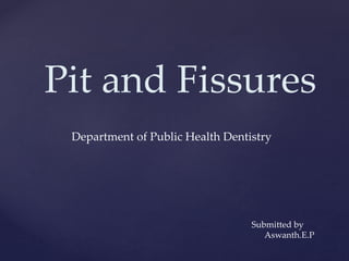 Pit and Fissures
Department of Public Health Dentistry
Submitted by
Aswanth.E.P
 