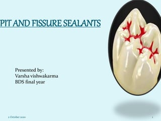 PIT AND FISSURE SEALANTS
Presented by:
Varsha vishwakarma
BDS final year
2 October 2020 1
 