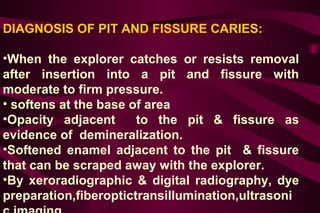 PROCEDURE OF PIT AND FISSURE SEALANT
APPLICATION:
•CLEAN THE TOOTH SURFACE:
Remove plaque & debris from enamel and pits &...