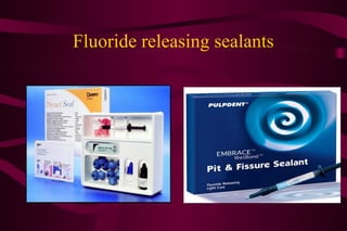 SEALANTS          IN      CARIES        MANAGEMENT
PROGRAMME:
Identification of a patient at risk of decay.
A thorough a...