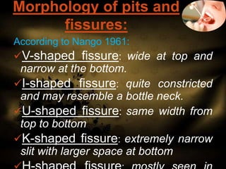 Morphology of pits and
fissures:
According to Nango 1961:
V-shaped fissure: wide at top and

narrow at the bottom.
I-sha...