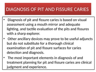PIT AND FISSURE SEALING.pptx dentistry dental | PPTX