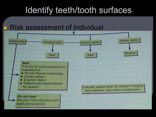 Identify teeth/tooth surfaces
 Risk assessment of individual
 