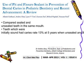 • Compared sealed and
unsealed teeth in the same mouth.
• Teeth which were
initially sound had caries rate 13% at 5 years when unsealed and 8
 