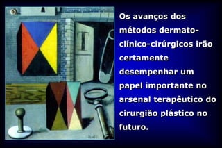 Os avanços dos
métodos dermato-
clínico-cirúrgicos irão
certamente
desempenhar um
papel importante no
arsenal terapêutico do
cirurgião plástico no
futuro.
 