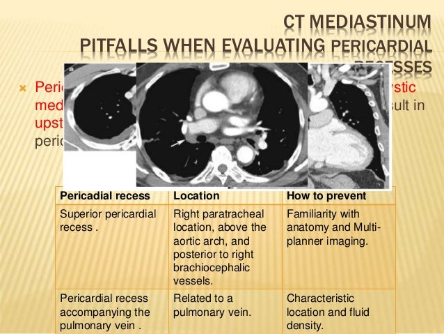 Pitfalls in ct chest