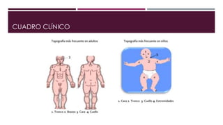 CUADRO CLÍNICO 
 