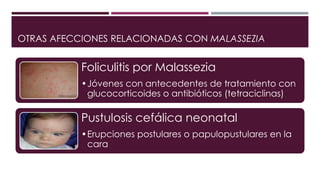 OTRAS AFECCIONES RELACIONADAS CON MALASSEZIA 
Foliculitis por Malassezia 
•Jóvenes con antecedentes de tratamiento con 
glucocorticoides o antibióticos (tetraciclinas) 
Pustulosis cefálica neonatal 
•Erupciones postulares o papulopustulares en la 
cara 
