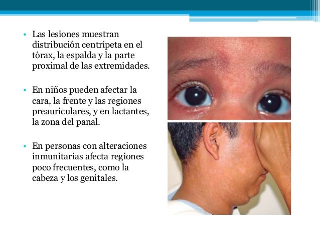 Por que hay unas manchas de pigmento sobre la persona a la mujer